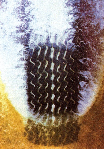 1673045306682 Getagripontraction